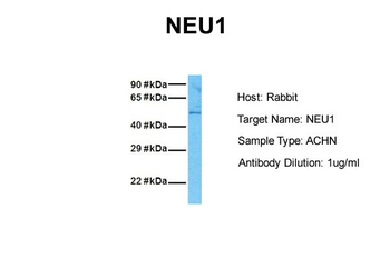 NEU1 Rabbit Polyclonal Antibody