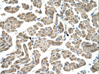 NEU1 Rabbit Polyclonal Antibody