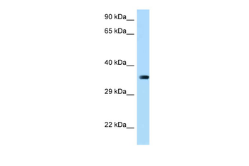 MARCH2 Rabbit Polyclonal Antibody