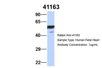 SEPT11 Rabbit Polyclonal Antibody