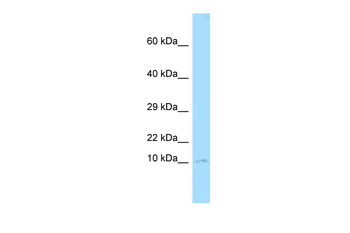 Cks1b Rabbit Polyclonal Antibody