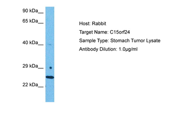 EMC7 Rabbit Polyclonal Antibody