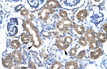 CBX4 Rabbit Polyclonal Antibody