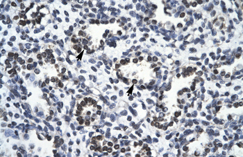 RBM10 Rabbit Polyclonal Antibody