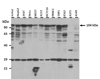 RBM10 Rabbit Polyclonal Antibody