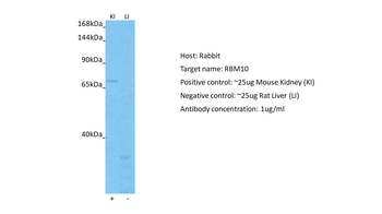 RBM10 Rabbit Polyclonal Antibody