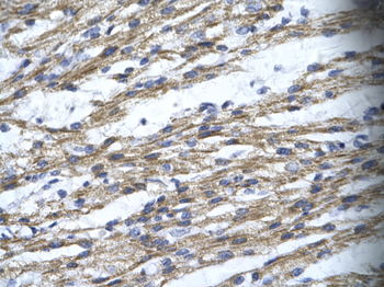 RBM10 Rabbit Polyclonal Antibody