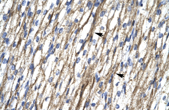 RBM10 Rabbit Polyclonal Antibody