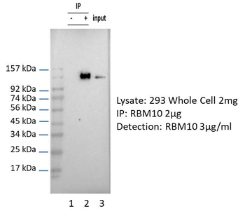 RBM10 Rabbit Polyclonal Antibody
