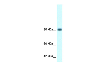 RBM10 Rabbit Polyclonal Antibody
