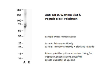 TAF15 Rabbit Polyclonal Antibody