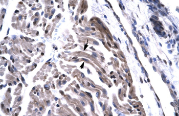 TAF15 Rabbit Polyclonal Antibody