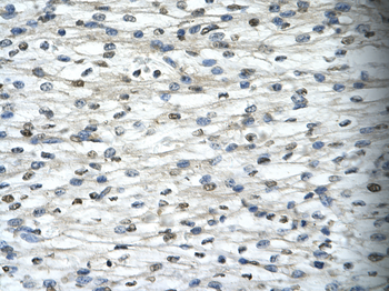 TAF15 Rabbit Polyclonal Antibody