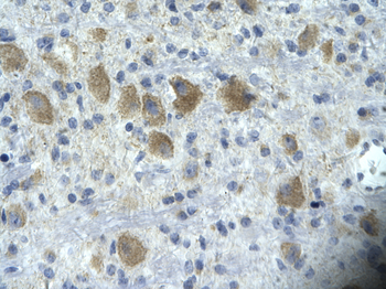 TAF15 Rabbit Polyclonal Antibody