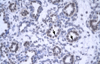 YEATS4 Rabbit Polyclonal Antibody