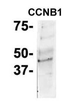 CCNB1 Rabbit Polyclonal Antibody