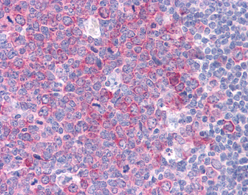 HSP90AA1 Rabbit Polyclonal Antibody