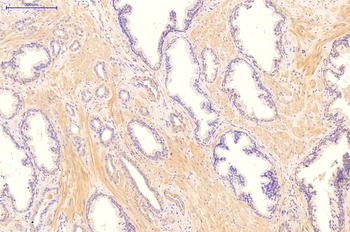 CDKN1A Rabbit Polyclonal Antibody