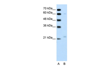 RGS4 Rabbit Polyclonal Antibody