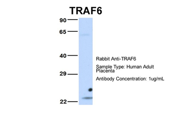 TRAF6 Rabbit Polyclonal Antibody