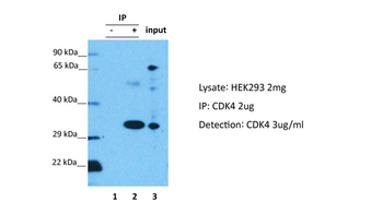 CDK4 Rabbit Polyclonal Antibody