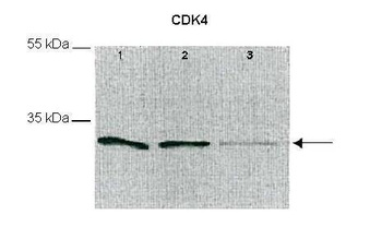 CDK4 Rabbit Polyclonal Antibody