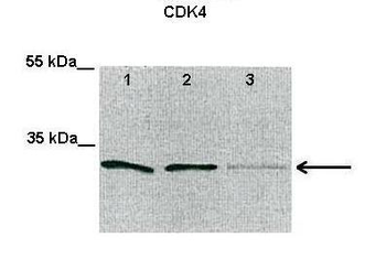 CDK4 Rabbit Polyclonal Antibody