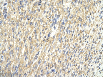 CDK4 Rabbit Polyclonal Antibody