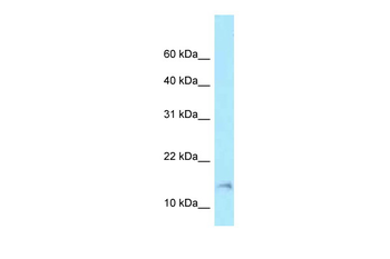 BAD Rabbit Polyclonal Antibody