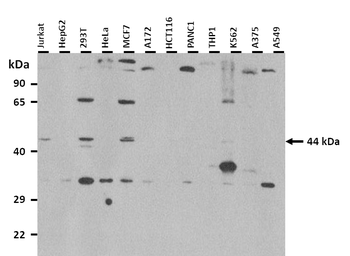 TP53 Rabbit Polyclonal Antibody