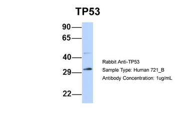 TP53 Rabbit Polyclonal Antibody