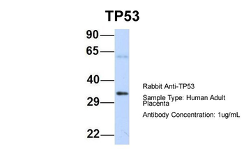 TP53 Rabbit Polyclonal Antibody