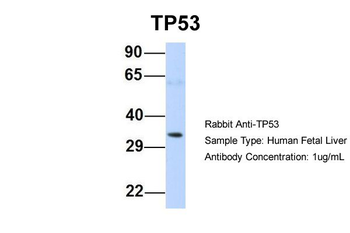 TP53 Rabbit Polyclonal Antibody