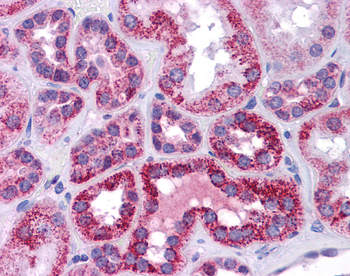 TP53 Rabbit Polyclonal Antibody