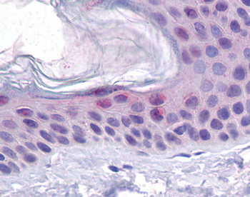 TP53 Rabbit Polyclonal Antibody