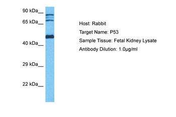 TP53 Rabbit Polyclonal Antibody