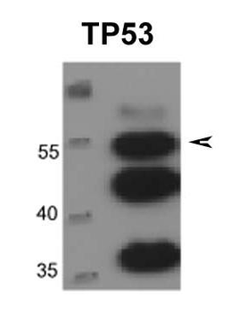 TP53 Rabbit Polyclonal Antibody