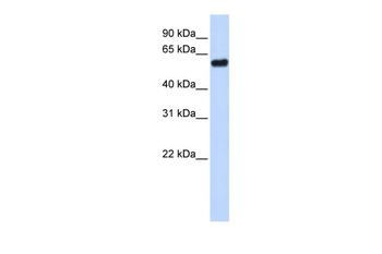 TP53 Rabbit Polyclonal Antibody