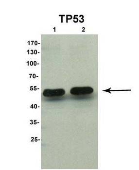 TP53 Rabbit Polyclonal Antibody
