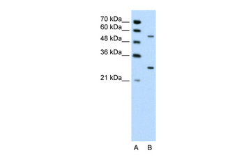 PDPK1 Rabbit Polyclonal Antibody