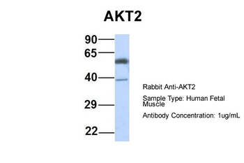 AKT2 Rabbit Polyclonal Antibody