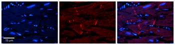 AKT2 Rabbit Polyclonal Antibody