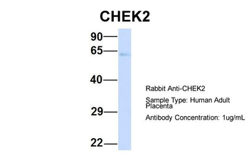 CHEK2 Rabbit Polyclonal Antibody