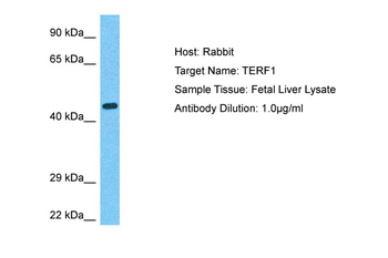 TERF1 Rabbit Polyclonal Antibody