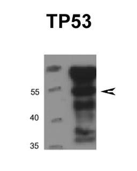 TP53 Rabbit Polyclonal Antibody
