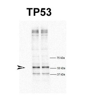 TP53 Rabbit Polyclonal Antibody