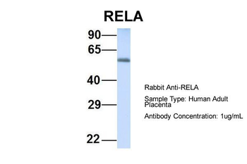 RELA Rabbit Polyclonal Antibody
