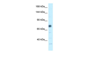 BRCA1 Rabbit Polyclonal Antibody