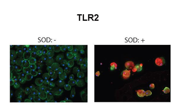 TLR2 Rabbit Polyclonal Antibody