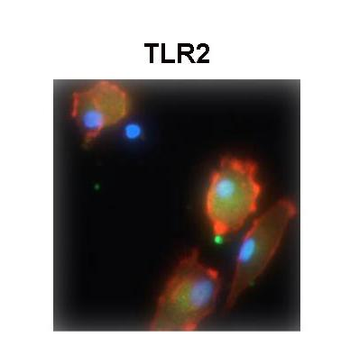 TLR2 Rabbit Polyclonal Antibody